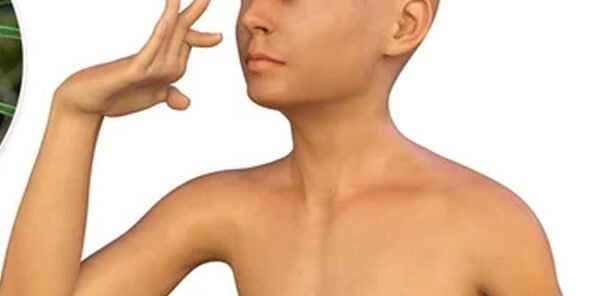 Coreia de Sydenham Coreia de Sydenham