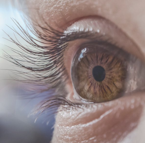 O que é Neuromielite Óptica? O que é Neuromielite Óptica?