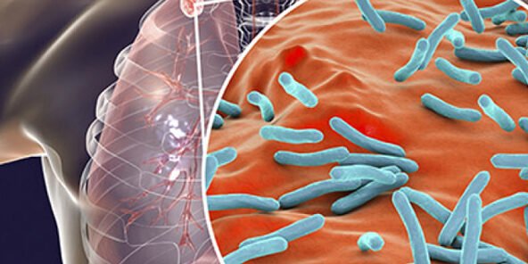 dia-nacional-da-tuberculose