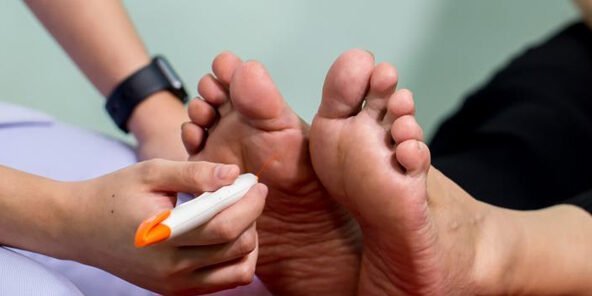 polineuropatia-diabetica