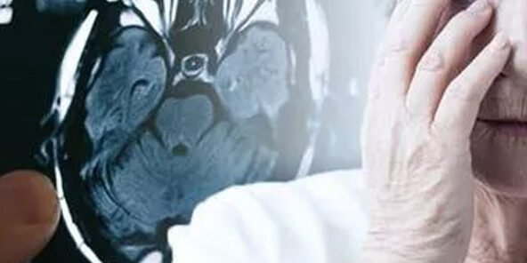 Demência Frontotemporal