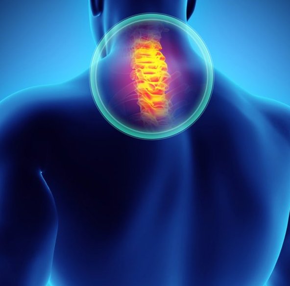 traumas-raquimedulares Como ocorre o trauma Raquimedular?