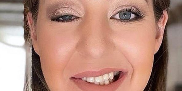 Síndrome de Ramsay – Hunt Síndrome de Ramsay - Hunt