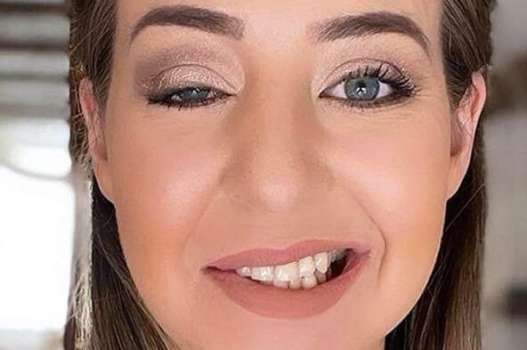 Síndrome de Ramsay - Hunt