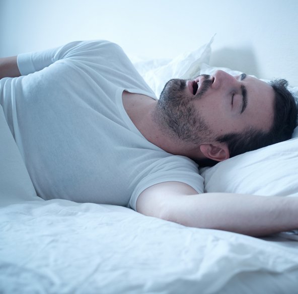 Transtorno Comportamental do Sono REM Transtorno Comportamental do Sono REM