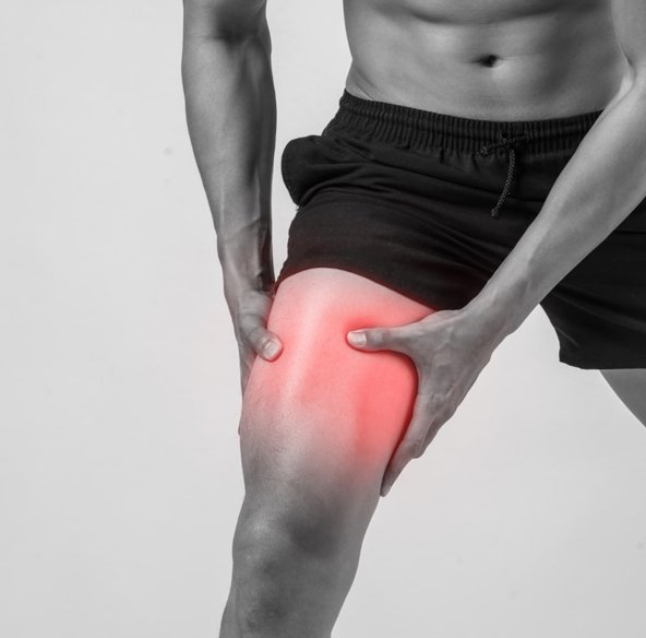 O que é Meralgia Parestésica O que é Meralgia Parestésica