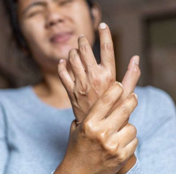 Síndrome Dolorosa Regional Complexa Síndrome Dolorosa Regional Complexa