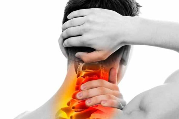 Cefaleia cervicogênica