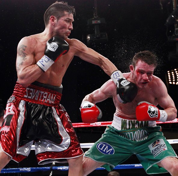 Encefalopatia Traumática Crônica