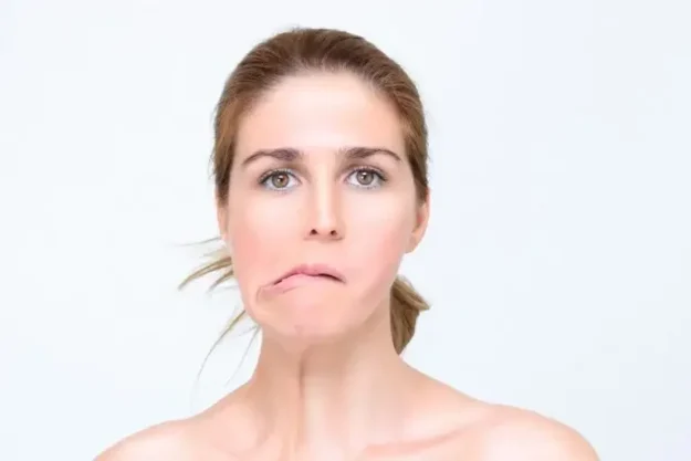 paralisia facial paralisia facial