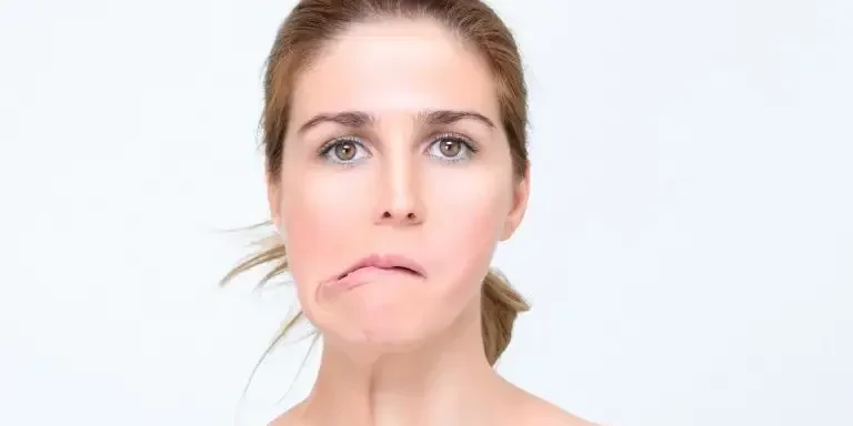 paralisia facial paralisia facial